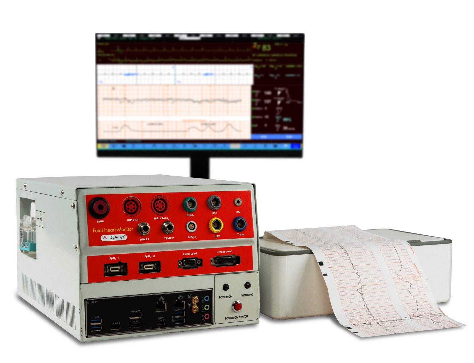 DyAnsys FHM Fetal Heart/Maternal Monitor (not yet available for sale in the US)