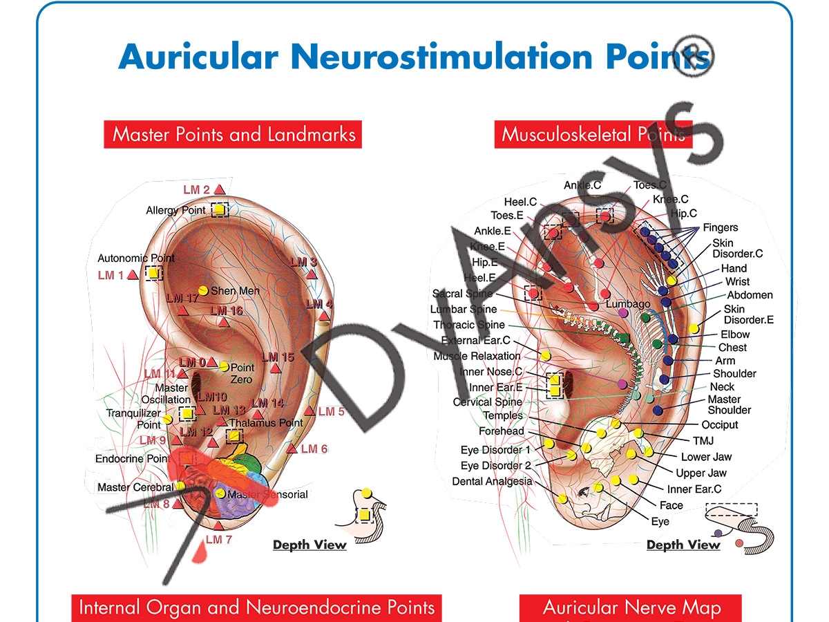 Auricular Neurostimulation Poster